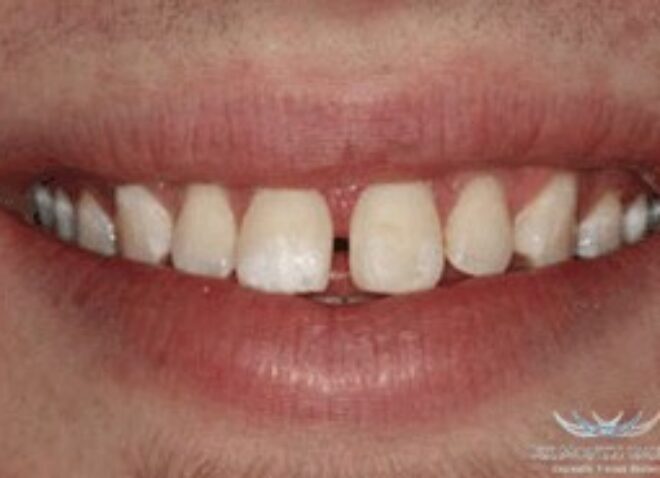 Before - Dentistree Dental