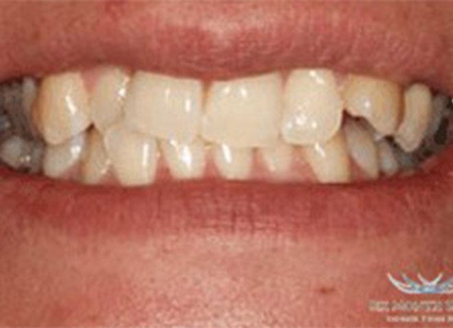 Before - Dentistree dental