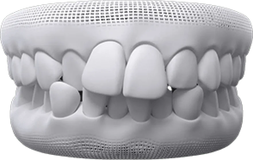 teeth-thumb01