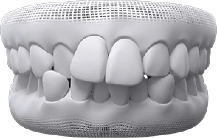 teeth-thumb04