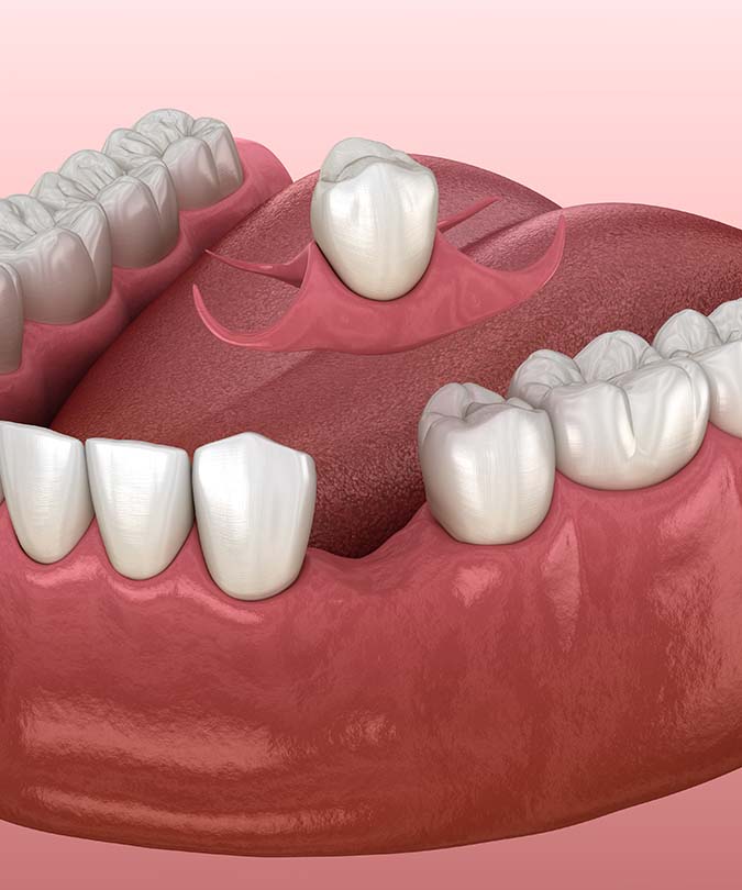 Treatment - Dentistree dental